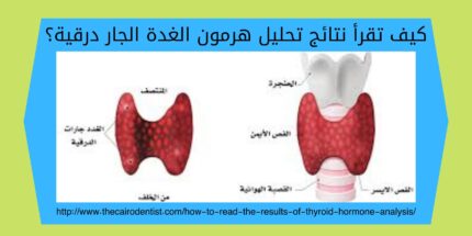 تحليل هرمون الغدة الجار درقية؟