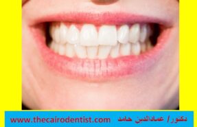 أكثر 10خرافات شائعة حول طب الأسنان