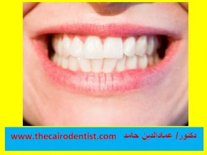 أكثر 10خرافات شائعة حول طب الأسنان